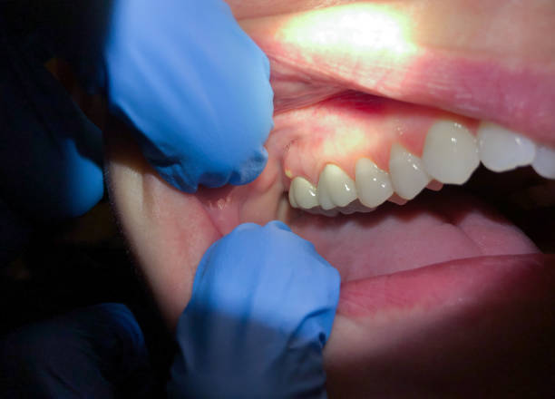 Best 24-Hour Emergency Dental Care in Hiawatha, KS