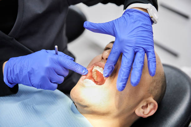 Best Emergency Wisdom Tooth Extraction in Hiawatha, KS