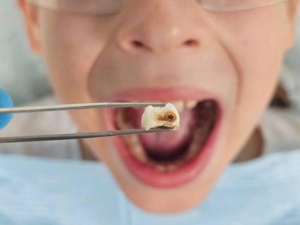 Best Emergency Denture Repair in Hiawatha, KS
